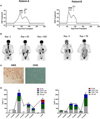 Non-uniform in vivo Expansion of Epstein-Barr Virus-Specific T-Cells Following Donor Lymphocyte Infusion for Post-transplant Lymphoproliferative Disease